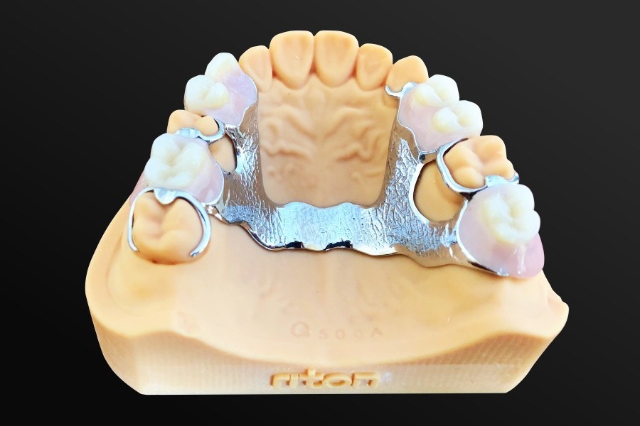 3d Laser Sintering Printer 2050 μM Dmls Metal Dental Prostheses 3d