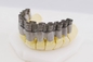 FCC 3D Dental Printer Dual Fiber Laser Digital 20-60μM Crowns And Dentures 3D Printer