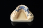 Medical Dentistry SLM 3D Printer Adjustable Thickness Digital Printer