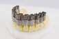 Single Fiber Laser 3D Metal Printer For Dental Jewelry Industry