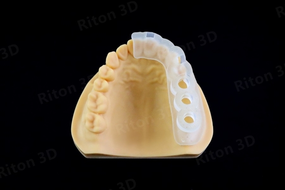 Low Viscosity Surgical Guide Resin For Dental Model 3d Printer