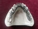 Cobalt Chromium Alloy Dental Titanium 3D Printer One Stop Denture Printing