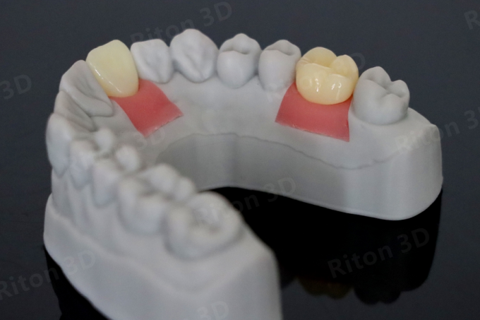 Gingiva Pink Resin For Dental Model 3d Printer ASTM D2240